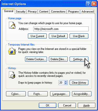 The Settings button